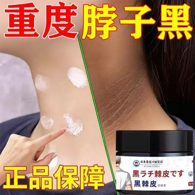 去脖子黑棘皮膏药黑色素沉淀去除颈部脖子黑肥胖洗不干净白神器30优惠商品图片