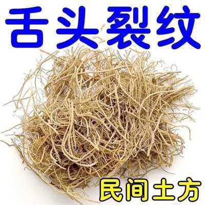 裂纹舌齿痕舌【正品保障】麻木灼热疼痛舌苔白黄厚腻口干口苦口臭