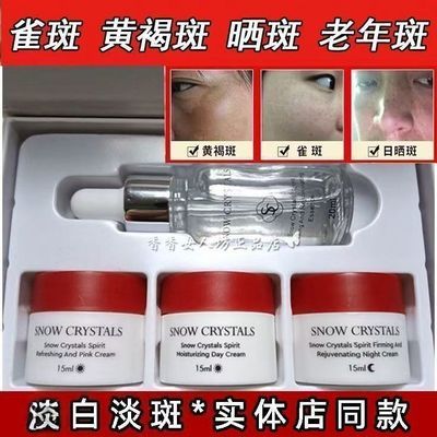优恋辅助美尚霜四件套补水保湿淡斑雀斑晒黄褐斑嫩白提亮肤色护肤