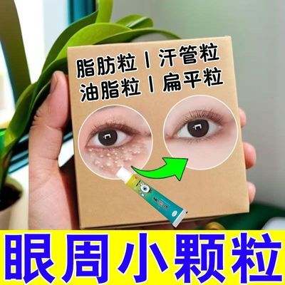 眼部脂肪粒汗管瘤油脂粒【不针挑不留疤】白色小颗粒正品眼膏
