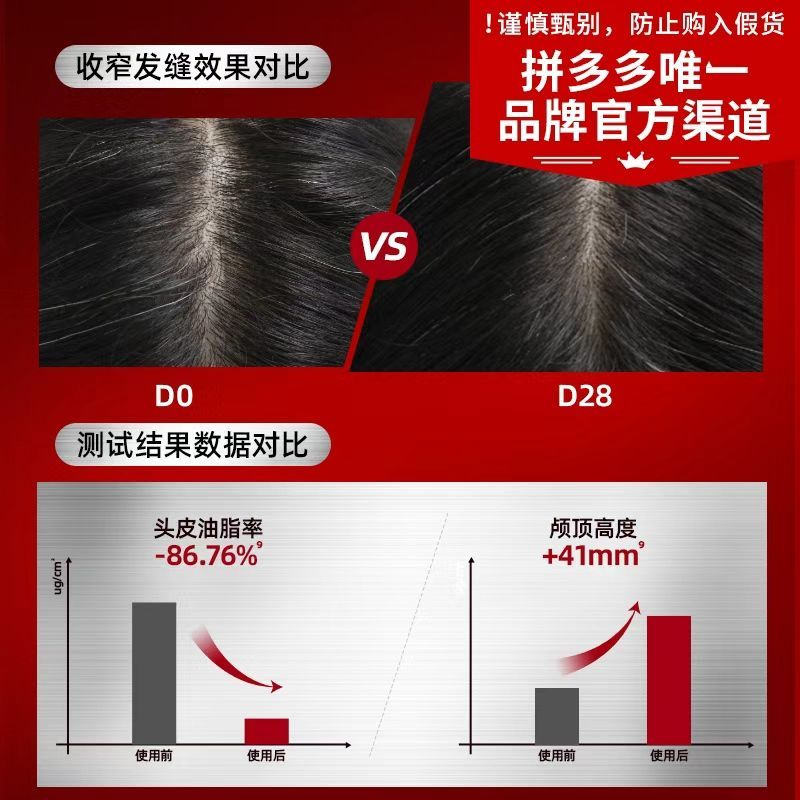 欧倍青洗发水Alpecin德国进口C1 咖啡因洗发水露250ML控油蓬松 图片 6