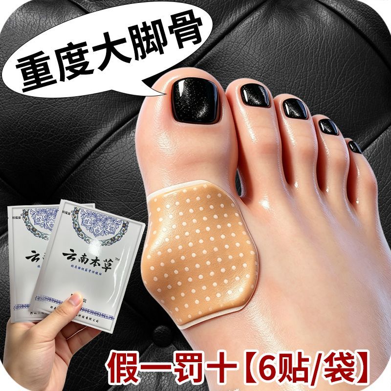正品严重大脚骨外翻贴凸出脚趾重叠关节畸形肿胀疼痛专用贴