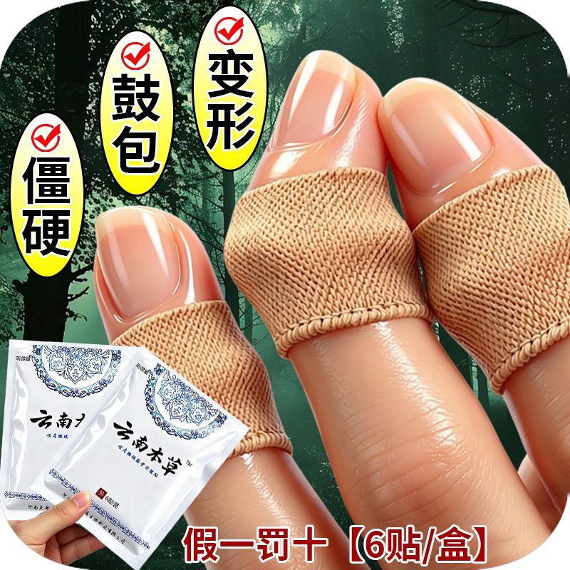 手指疼痛骨节粗大变形手指关节疙瘩鼓包骨关节指肿大消肿止痛膏