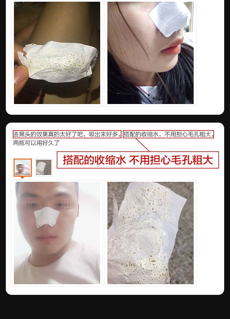 女生怎样去痘痘 90991dae-2597-4dc1-897c-d42e4d4552ca.jpeg