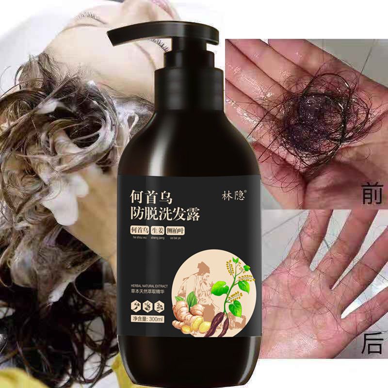 【真实生发案例】防脱生姜生发洗发水增发密发液控油去屑止痒露