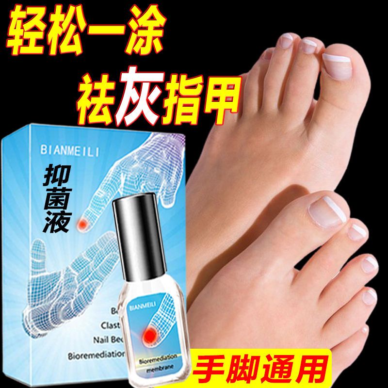 针对各类严重灰指甲灰甲克星去除顽固厚甲增甲软甲修复抑菌液