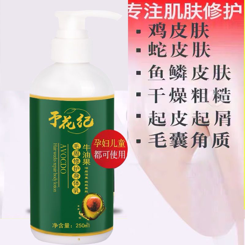 鸡皮疙瘩在哪买(鸡皮疙瘩摸什么药)