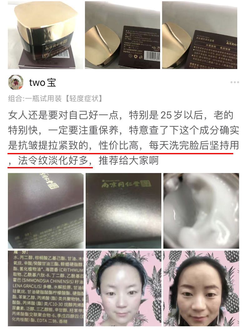 怎么去脸上的法令纹和抬头纹 6ad83aa1-4374-4495-b7b7-5820a87081d5.jpeg.a.jpeg