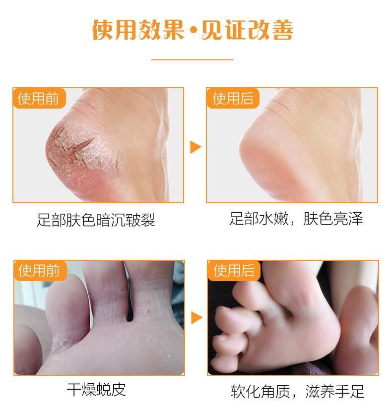 马油膏手脚干燥手足裂口开裂脱皮脚后跟开裂防裂膏防裂护手护脚霜