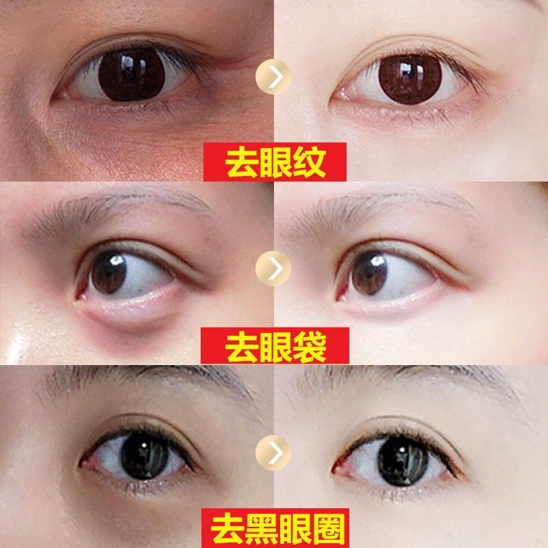 眼霜正品抗皱纹去除淡化黑眼圈眼袋细纹脂肪粒眼部熬夜修护神器