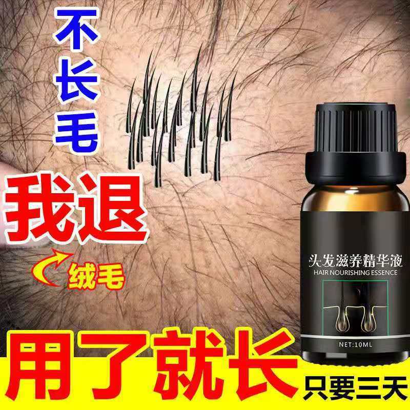 【用了就长】生发剂增发密发生发液快速变长普拉惠小黑瓶防脱发育