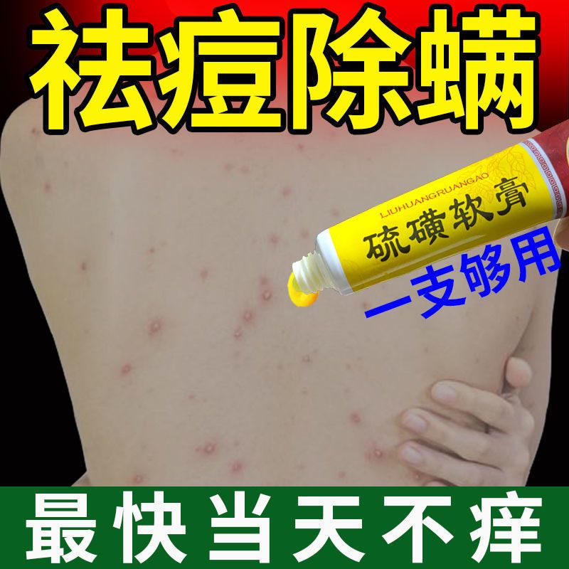 硫磺软膏抑菌止痒疥疮螨虫阴虱皮炎湿疹头癣手足体癣皮肤瘙痒