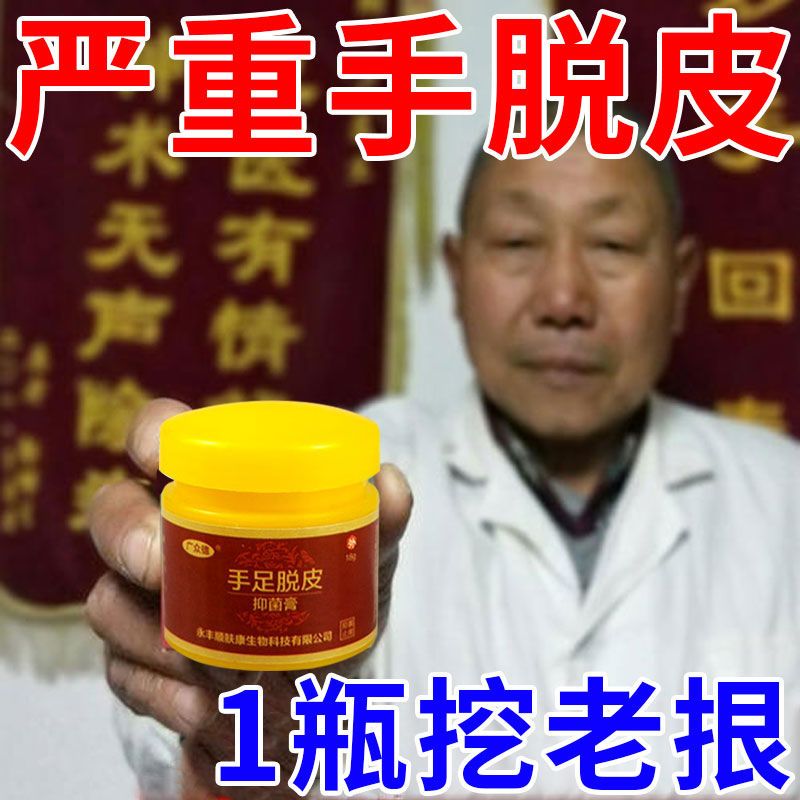 治手脱皮膏手气膏小水泡季节性手足脱皮干裂护手霜特效抑菌止痒膏