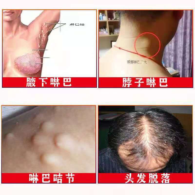 夏枯草郁金猫抓草甲状腺结节袋泡茶散节茶清热去火一份15包中药材_虎窝拼