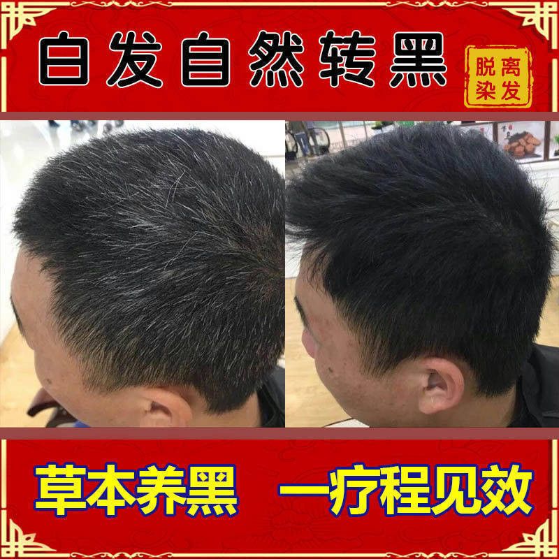 【黑发神器】南京同仁堂白发转黑发黑灵芝洗发水首乌草本中药控油-领