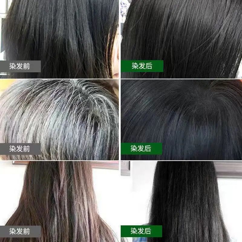 白头发能变黑多久 7215e29a-923d-41cc-a309-c4027a2e1a60.jpeg.a.jpeg