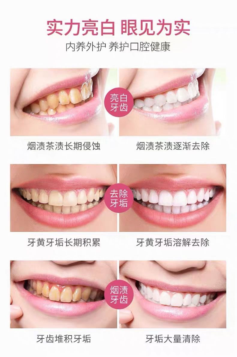 一瓶抵9瓶洗牙粉【不白退全款】 美白牙齿漱口水牙泡白去口臭  Yahoo 