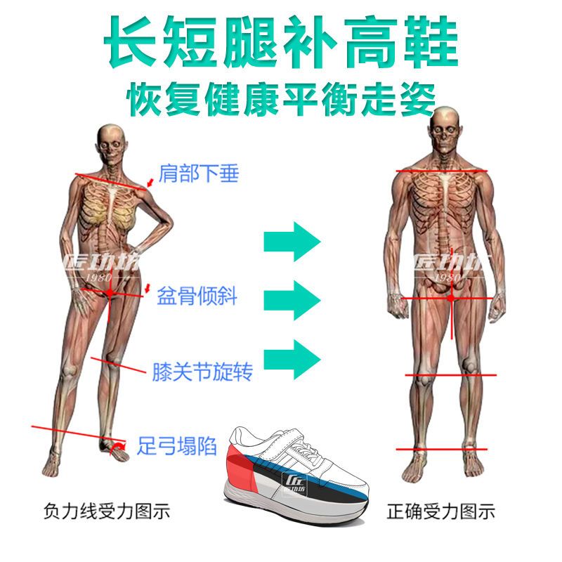 量脚定制残疾人补高鞋长短腿矫正高低鞋术后康复训练运动鞋跑鞋n1 12月17日发完 虎窝拼