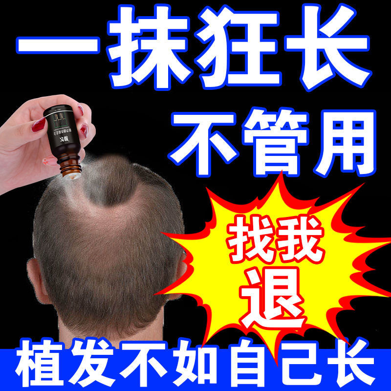 【全网爆款】生发增发密发生发液秃顶脂溢护发脱发生发液快速变长