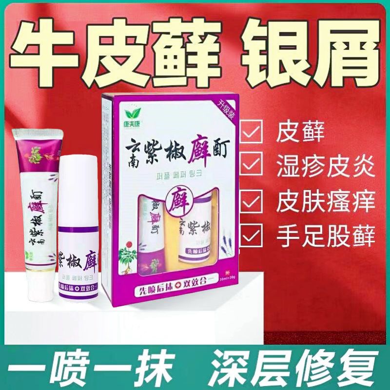 紫椒癣町酊牛皮癣银屑病皮肤病皮炎湿疹皮肤瘙痒外用抑菌止痒膏