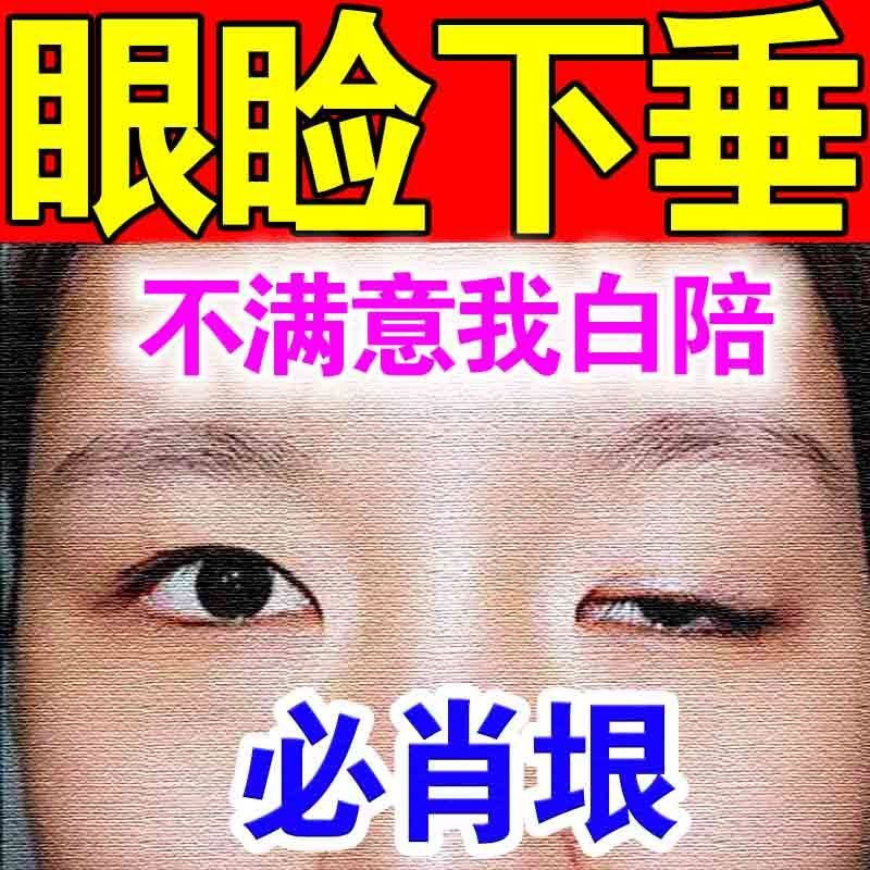 上眼睑下垂】提拉眼皮松弛眼皮松弛眼肌无力提上睑肌睑肌发育不良