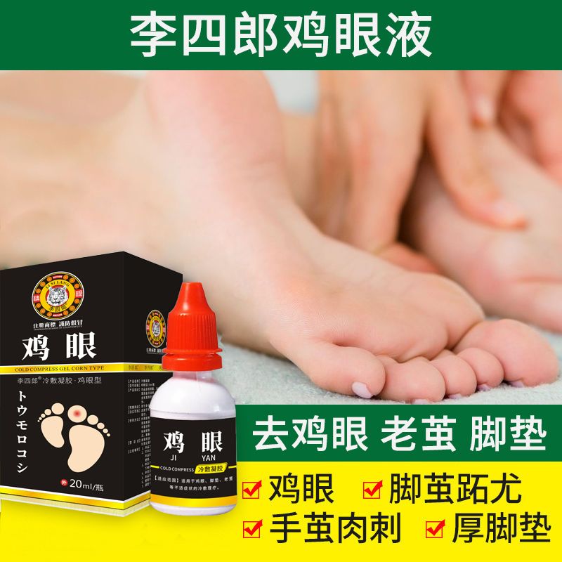 鸡眼药水】去手脚反复顽固鸡眼肉刺猴子鸡茧跖疣增厚脚趾死皮脚垫