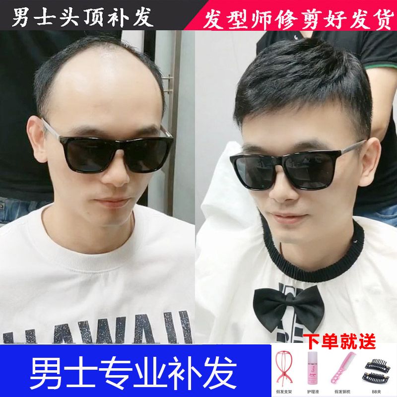 男士全真发假发片头顶补发片短发自然逼真可胶粘头顶真发补发块