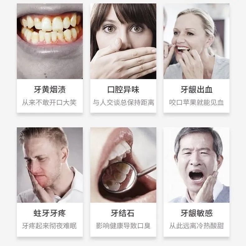 [Nanjing Tongrentang] genuine toothpaste whitens and removes yellowing, freshly whitens teeth, gums, halitosis, and smoke stains