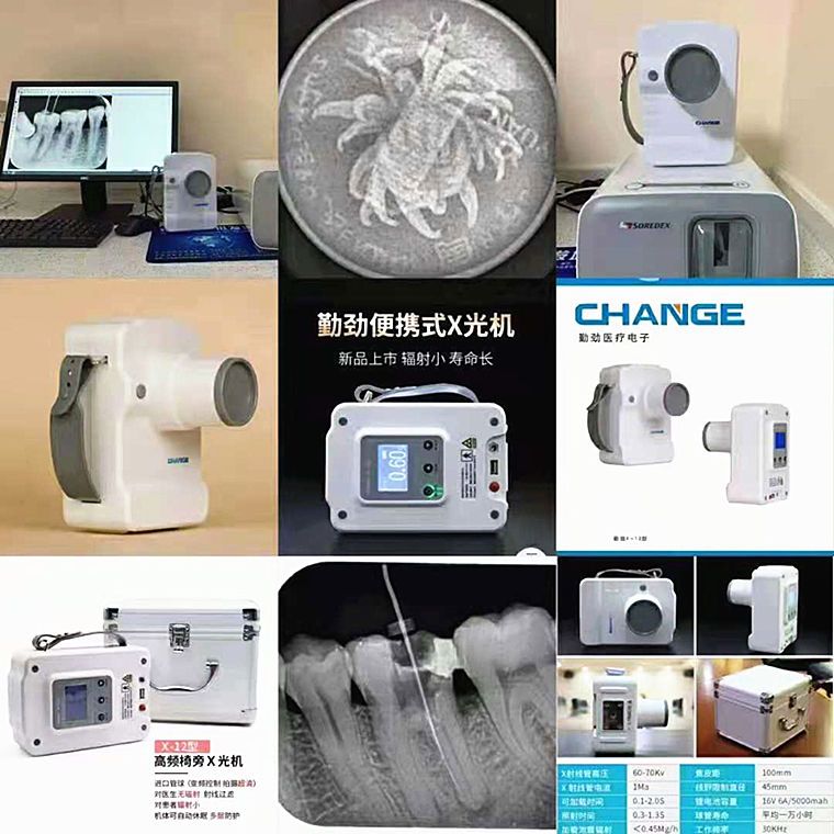 牙科拍片机 便携式x光射线机 枪式x光机拍片机 勤劲拍片机 传感器