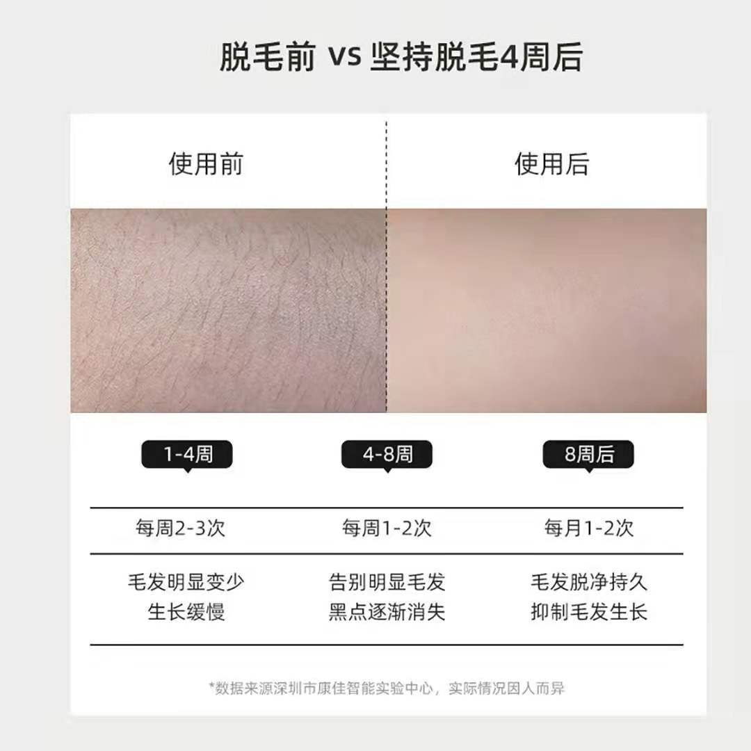 Konka康佳脱毛仪激动脱毛仪永久脱毛神器非冰点腋毛剃毛器腿毛 虎窝拼