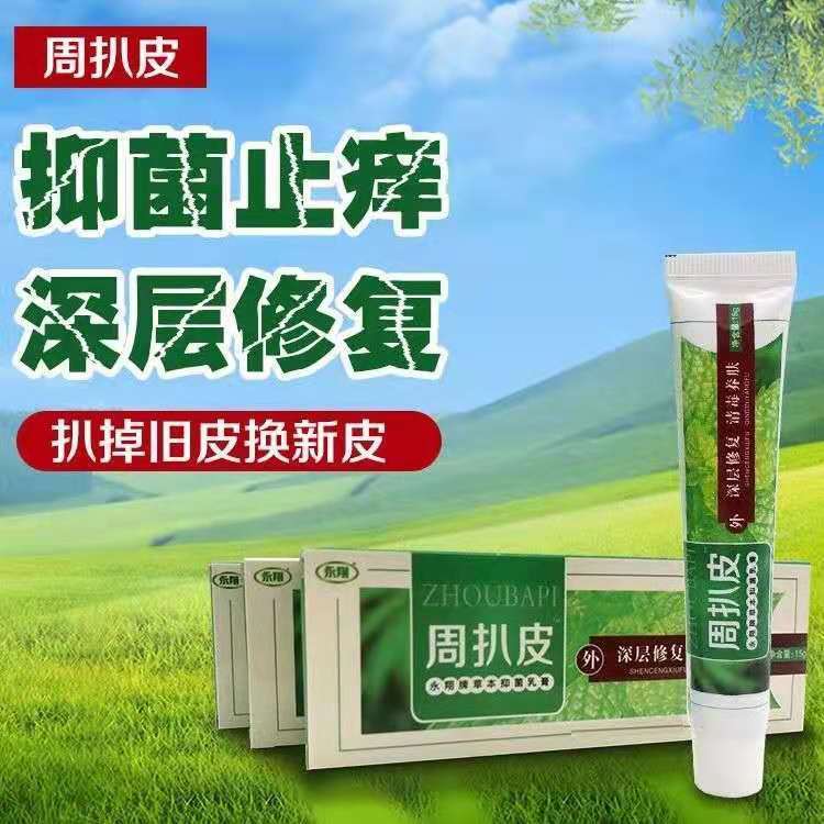 周扒皮黄皮肤皮肤止痒湿痒私痒皮焱湿疹护理抑菌软膏