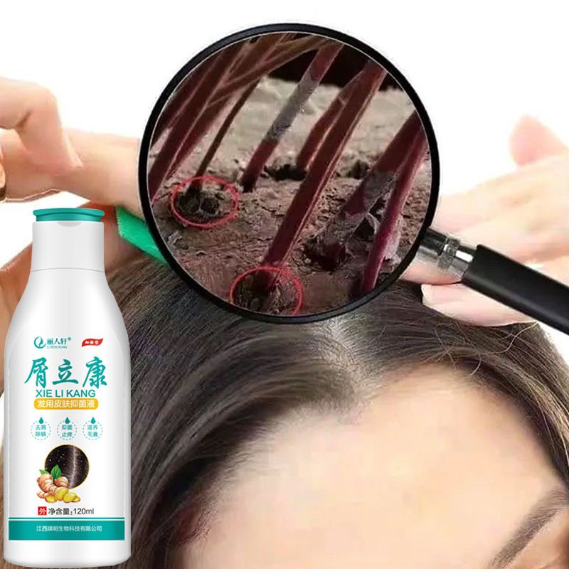 Dandruff Likang King Anti-dandruff, oil control, itching, mite removal, seborrheic scalp dandruff, follicle dermatitis shampoo