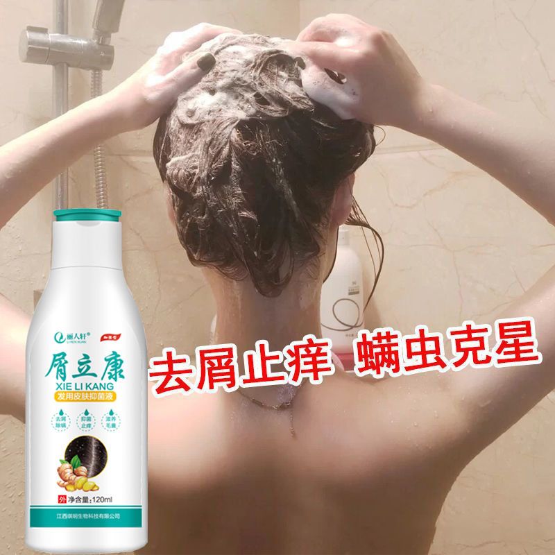 Dandruff Likang King Anti-dandruff, oil control, itching, mite removal, seborrheic scalp dandruff, follicle dermatitis shampoo