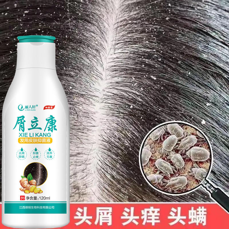 Dandruff Likang King Anti-dandruff, oil control, itching, mite removal, seborrheic scalp dandruff, follicle dermatitis shampoo