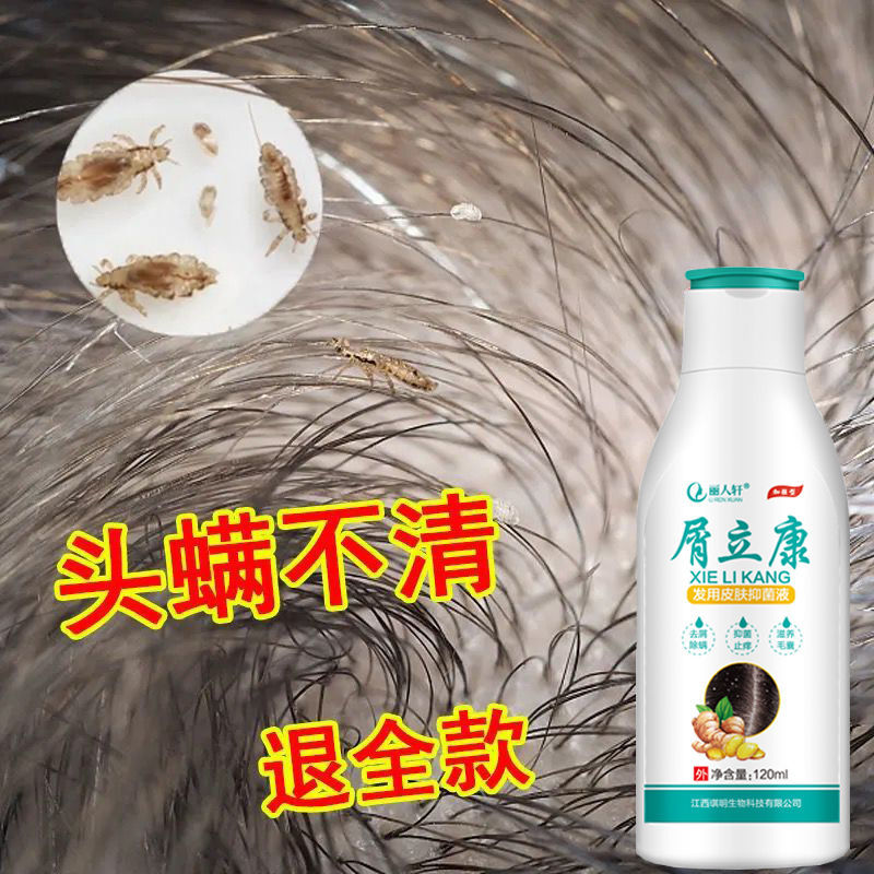 Dandruff Likang King Anti-dandruff, oil control, itching, mite removal, seborrheic scalp dandruff, follicle dermatitis shampoo