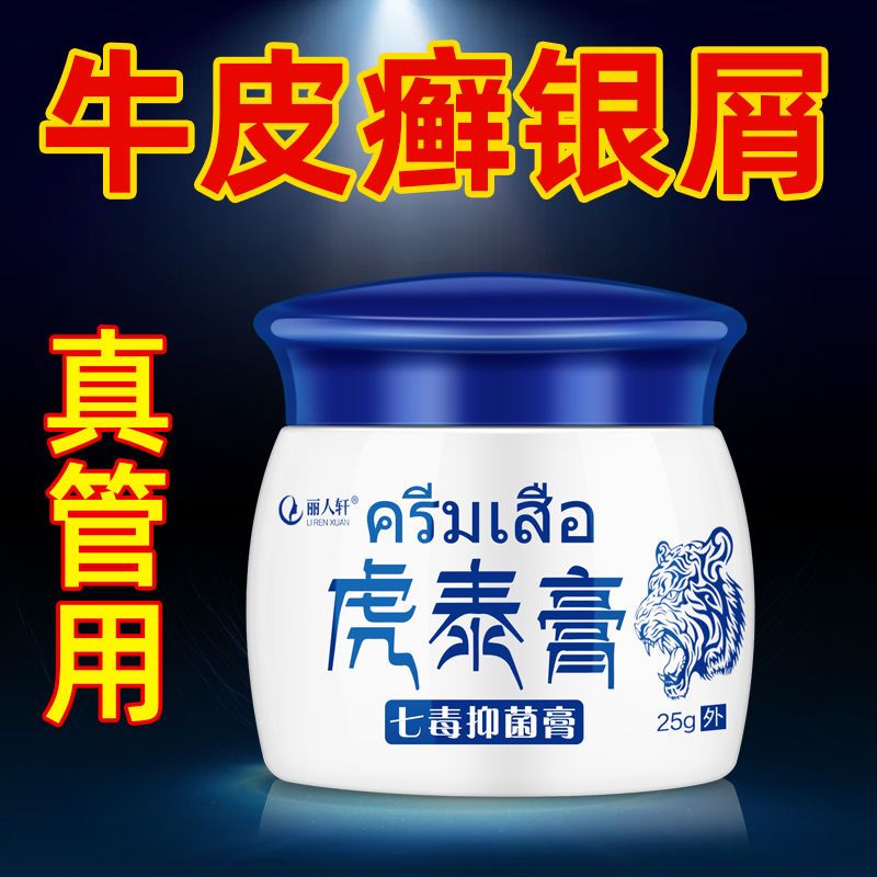 虎泰膏银屑病牛皮藓专用皮炎皮肤瘙痒头皮止痒外用专用湿疹特应性