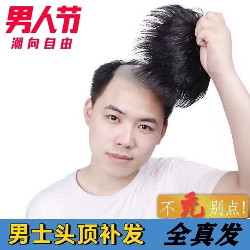 男士假发真发片男帅气头顶秃顶谢顶补发片隐形无痕逼真发头顶发片