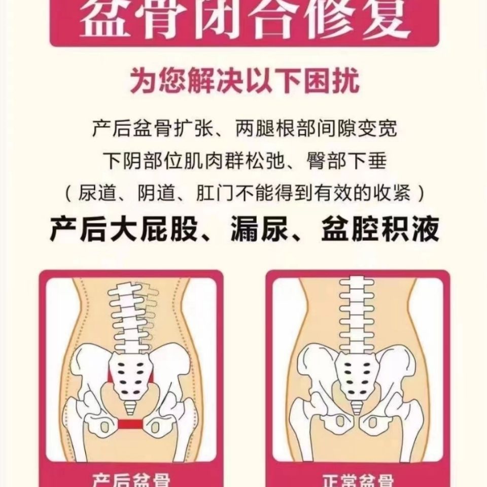 盆骨闭合胶囊修复盆肌底矫正体型收紧臀胯部骨盆前倾妇科产后修复 虎窝拼