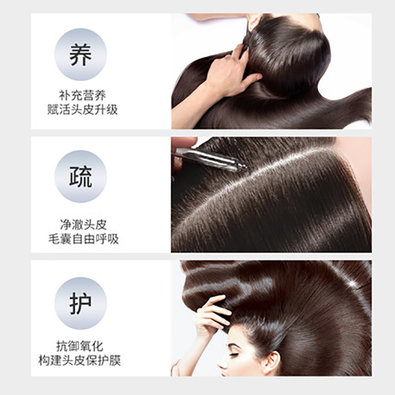 88621-霸王育发防脱发头皮营养液增发密发头发增长液旗舰店官网正品男女-详情图