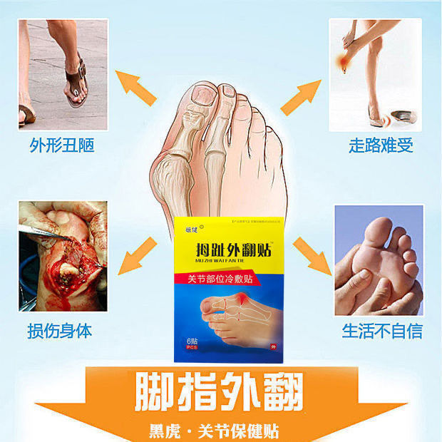 75618-成功率99%】拇外翻神器男女士大脚骨足外翻矫正器脚趾重贴专用贴-详情图