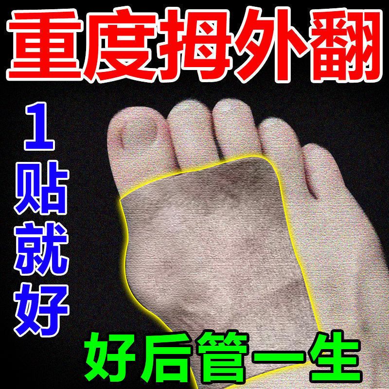 75618-成功率99%】拇外翻神器男女士大脚骨足外翻矫正器脚趾重贴专用贴-详情图