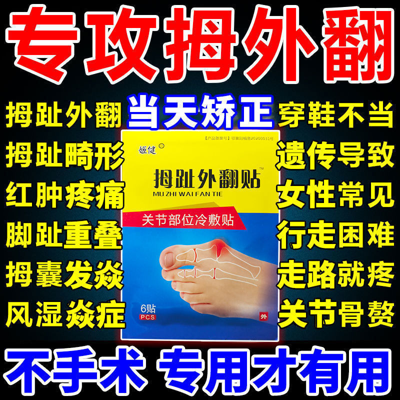 75618-成功率99%】拇外翻神器男女士大脚骨足外翻矫正器脚趾重贴专用贴-详情图