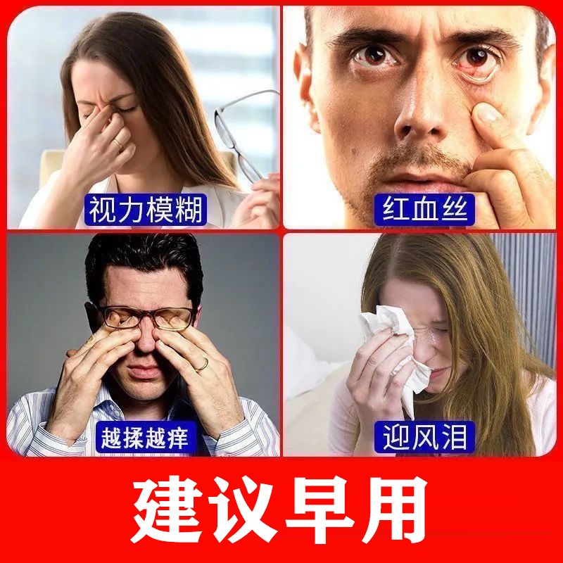 眼睛痒眼药水过敏发痒眼角痒干涩发痒视力模糊常流眼泪止痒滴眼液 虎窝拼