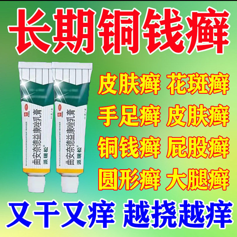 铜钱癣花斑癣皮肤癣头皮癣手足股癣瘙痒红斑脱皮真菌感染止痒药z