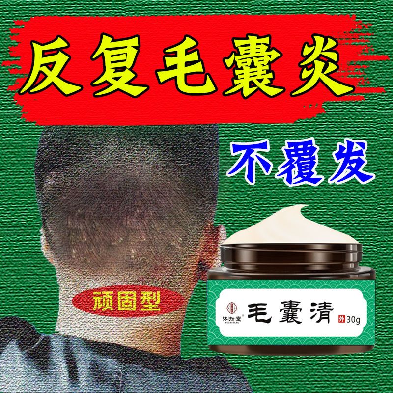 头皮毛囊炎脂溢性皮炎洗发水去头皮红斑疙瘩脓包扣出颗粒去屑止痒