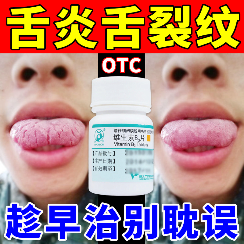 【舌炎吃什么药】舌头麻木有裂纹地图舌红肿疼痛溃烂维生素b2片