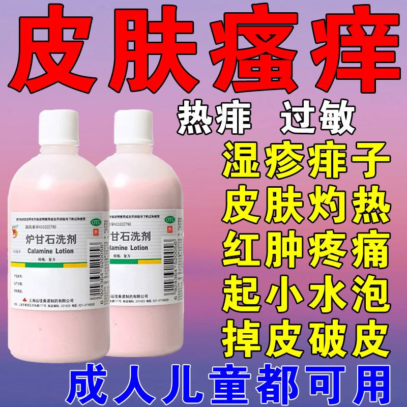 炉甘石洗剂湿疹止痒丘疹身上起红点痱子去湿痒治皮肤瘙痒止痒药水
