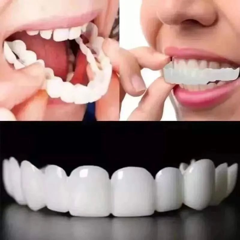 第20代仿真假牙塑形牙套老人吃饭神器遮瑕缺牙填充牙缝补牙临时牙
