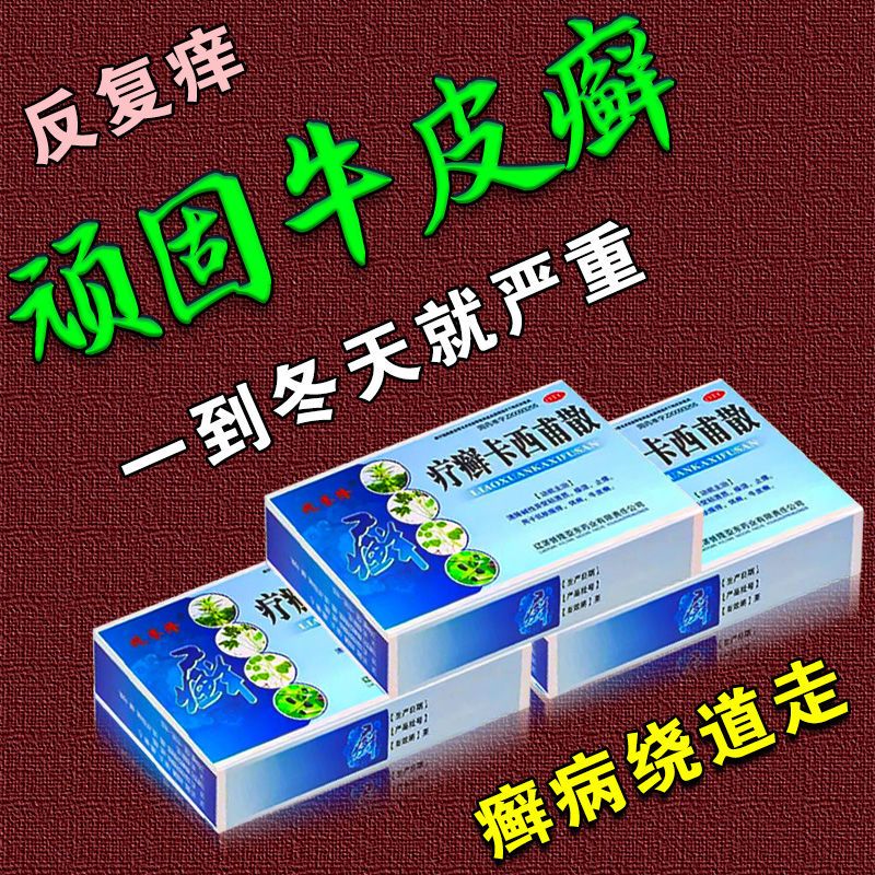 牛皮癣口服药银屑病瘙痒红肿鳞屑干裂掉皮燥湿止痒疗癣卡西甫散