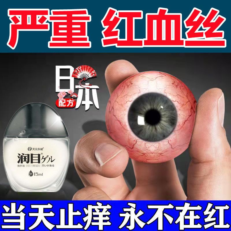 红血丝眼睛充血滴眼液眼红肿眼睛痛红眼迎风流泪疲劳
